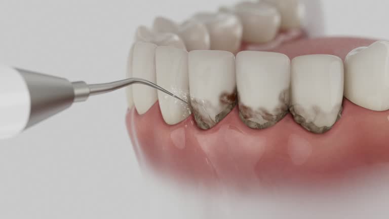 Trusted Tooth Extraction service in Southern Gateway, VA - Dentist Open Now